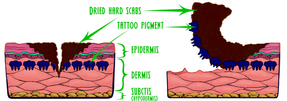 layers of skin diagram tattoo